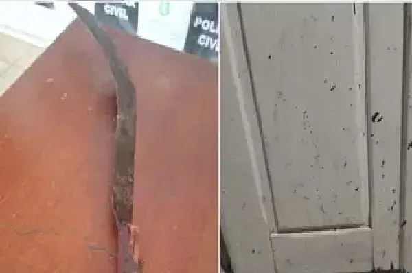 Vizinho ataca homem com foice e decepa mão durante briga
