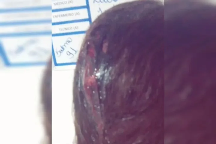 Mulher é apedrejada e foge de agressor: “Vou te matar”