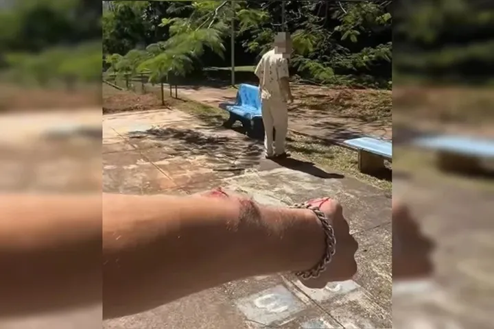 Homem relata agressão e braço quebrado após defender mulher