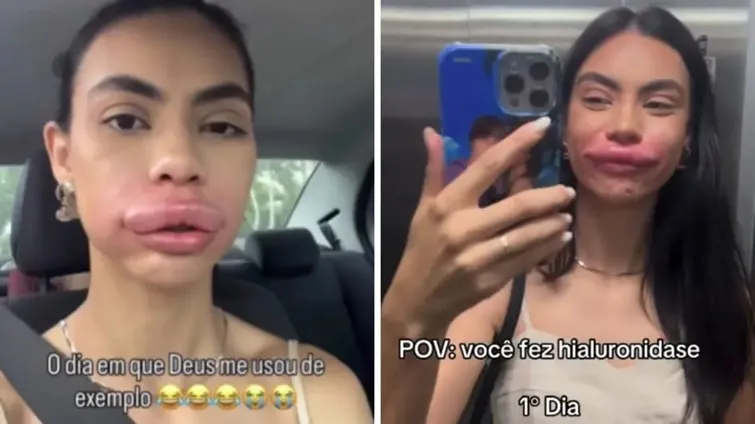 Redes sociais, Reprodução